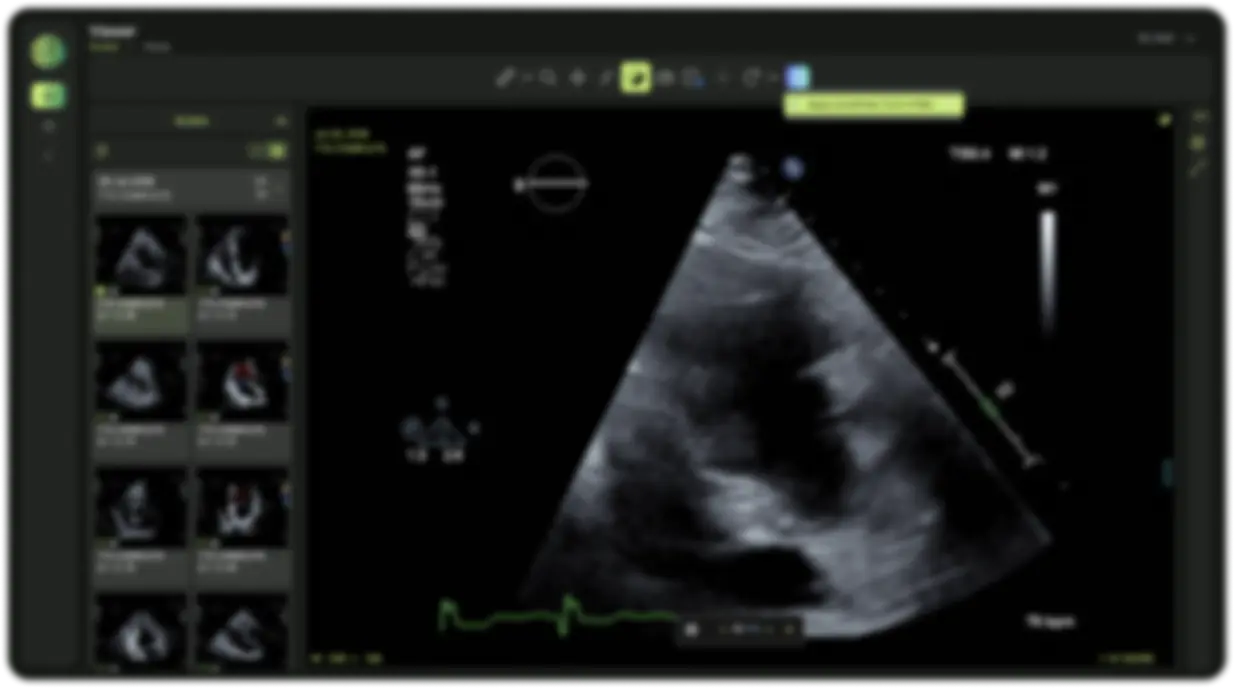 viewer placeholder blur